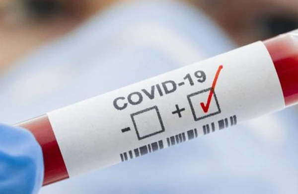 Azərbaycanda 21 nəfərin yoluxduğu kənddən YENİ XƏBƏR - VİDEO