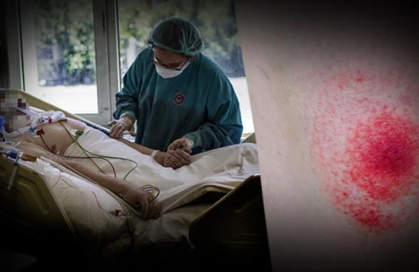 Azərbaycanın qonşusunda yeni dəhşətli virus yayılır - Bu dəfə daha qorxulu...
