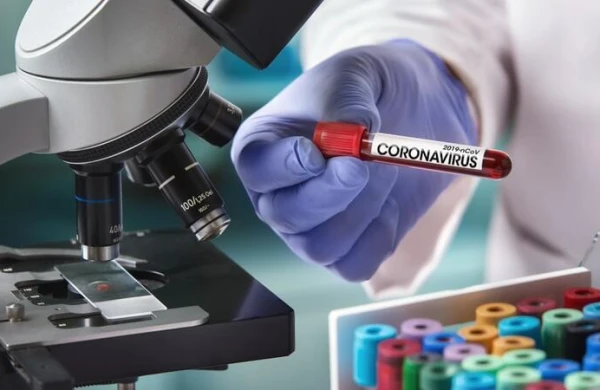 SON DƏQİQƏ! Azərbaycanda koronavirusdan ölənlərin sayı 100-ü ötdü