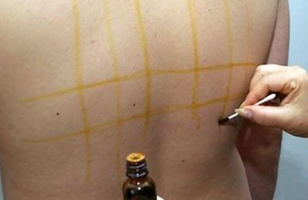 Yod kletkası çəkmənin orqanizmə faydası varmı?