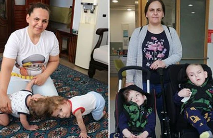 Siyam əkizlərini  başları əməliyyatla ayrıldı - Bir-birlərini gördükdə görün nə etdilər (VİDEO)