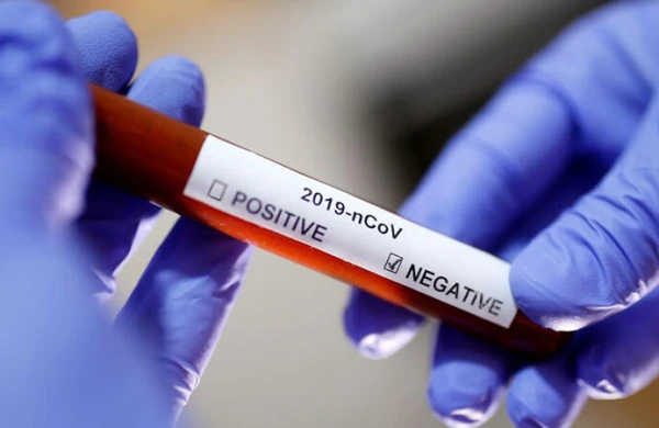 Daha bir həkim koronavirusa yoluxdu: "Həkimlərə sayğı göstərin"