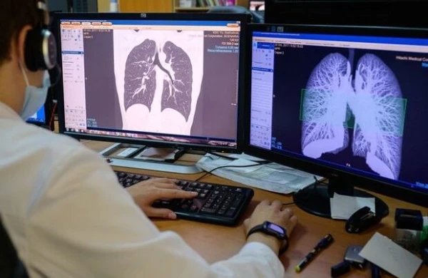 COVID-19-un müalicəsində effektli dərman tapıldı