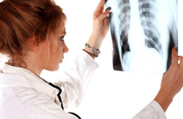 Ağciyərləri koronavirusdan bu məhsullar qoruya bilər