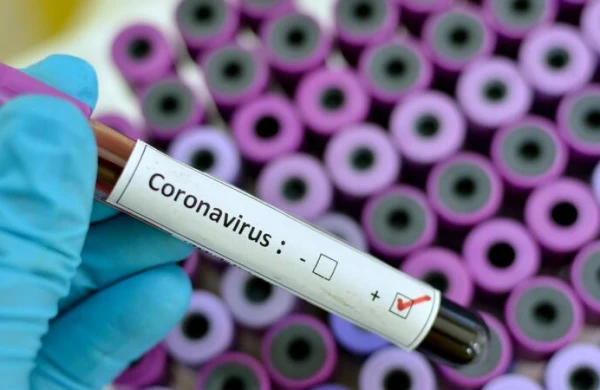 Azərbaycanda daha 471 nəfərdə koronavirus aşkarlandı - 5 nəfər öldü