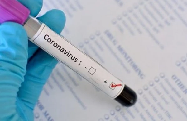 Azərbaycanda daha 478 nəfərdə koronavirus aşkarlandı