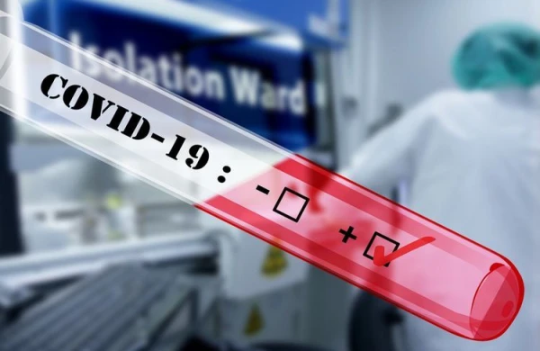 Azərbaycanda koronavirus testi ilə bağlı REKORD GÖSTƏRİCİ