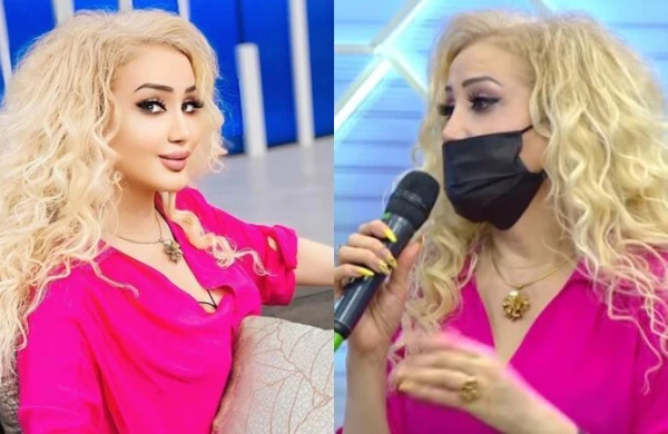 Fotoşopla özünü tanınmaz hala saldı - FOTO