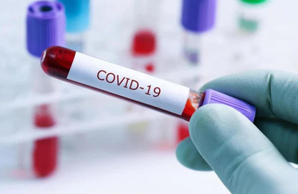 Azərbaycanda daha 537 nəfər koronavirusa yoluxdu, 7 nəfər öldü