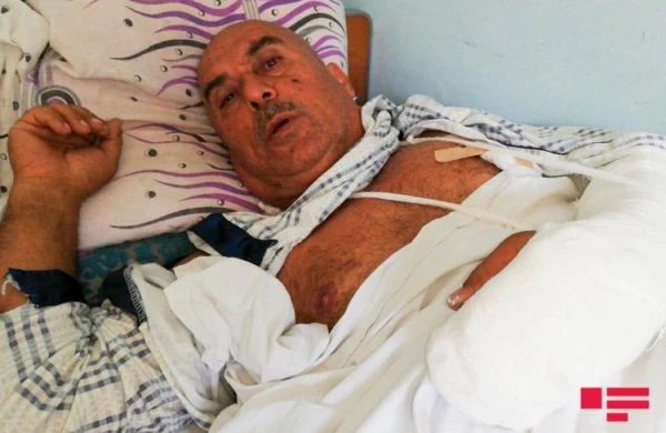 Sumqayıtda sərxoş şəxs qardaşını bıçaqlayıb - FOTO