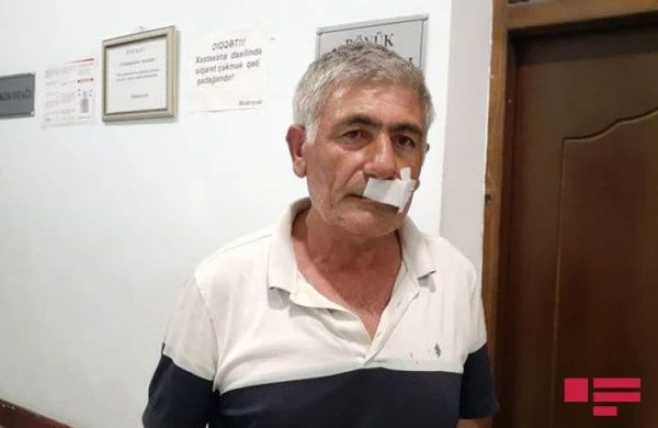 Xalq Artistinin qardaşını döydülər - Foto