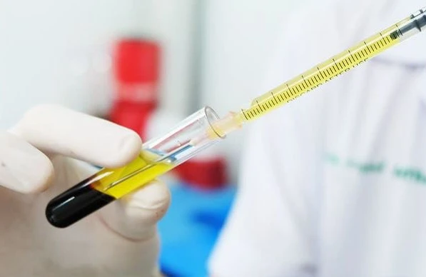 TƏBİB seroloji testlər keçirəcək