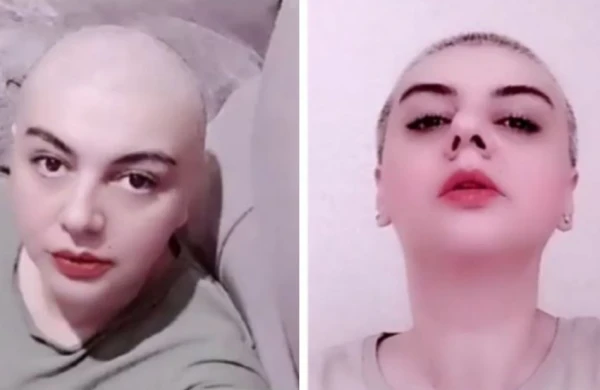 "Banu"nun Güneli niyə saçlarını keçəl etdi? — VİDEO