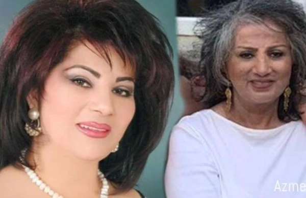 Əməkdar artist tanınmaz hala düşüb - FOTO