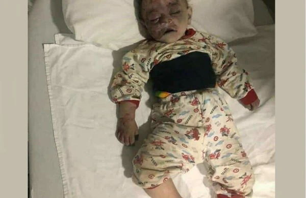 Ermənilər Gəncədə terror törətdi: Ölənlər arasında uşaqlar da var - Video