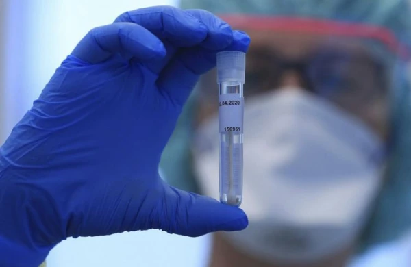 Ermənilər sürətlə qırılır: Koronavirus tüğyan edir