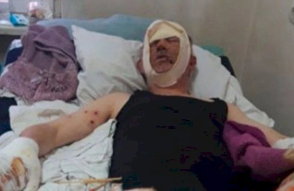 Erməni polkovnik Naftalanda müalicə olunur - FOTO