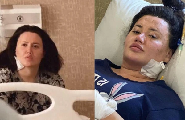Üçüncü dəfə əməliyyat olunan Ayselin vəziyyəti necədir? - FOTO