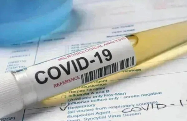 Yay aylarında Azərbaycanda koronavirusun güclü dalğası gözlənilir - Gürcü ekspert