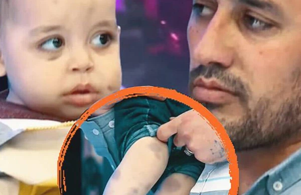 Üzücü XƏBƏR: 55 min pul yığılan 1 yaşlı uşaq vəfat etdi