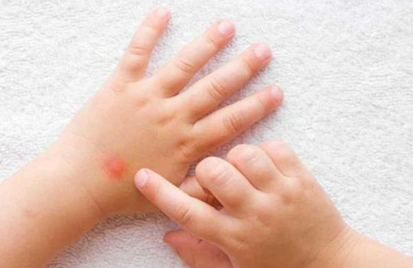 Dünyada yeni virus yayılır - “Pomidor qripi”