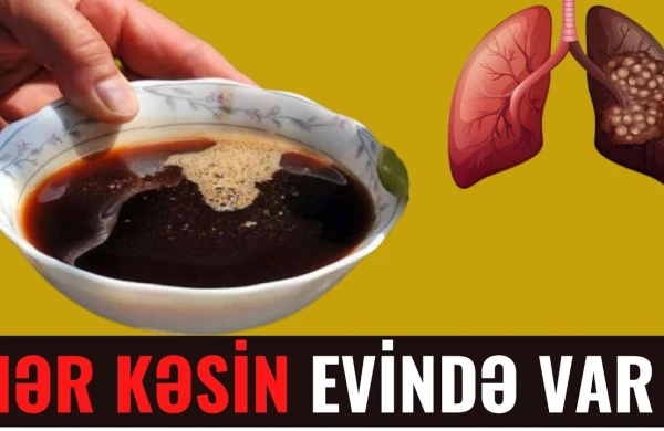 Ağciyəri Təmizləyən 8 Qida - Evdə üç Gün Etsəniz...