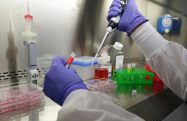 Rusiyada Meymun Çiçəyi Xəstəliyi İlə İlk Hal Təsdiqləndi