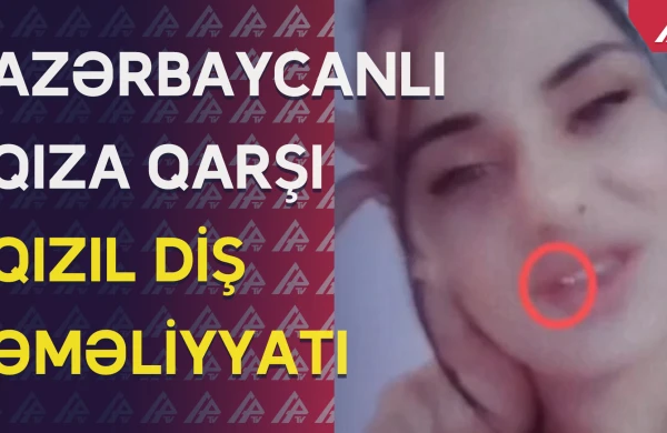 Polis qızıl dişli Ləmanı tutdu: Görün nə etdi - ŞOK VİDEO