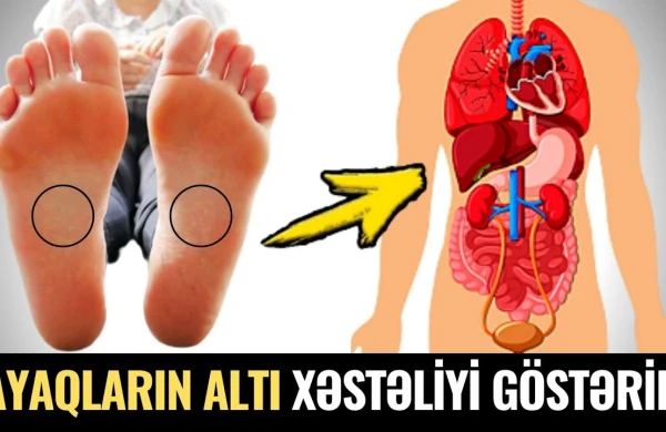 Ayaqların Altına Baxın! - 10 Saniyədə Xəstəliyinizi Biləcəksiz
