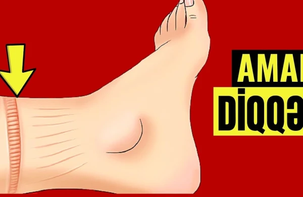 Ürəyinizin Düzgün İşləmədiyini göstərən 10 VACİB ƏLAMƏT