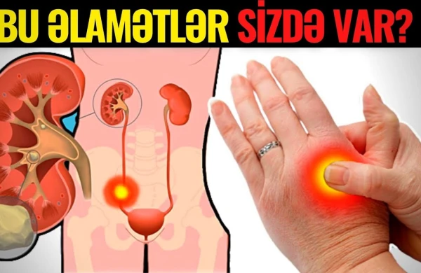 Böyrəkdə Problem Varsa - Bu 10 Əlamət Olur