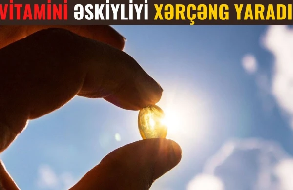 DİQQƏT! Bu Əlamətlər D Vitamini ƏksiyliyiniN Göstəricisidir (VİDEO)