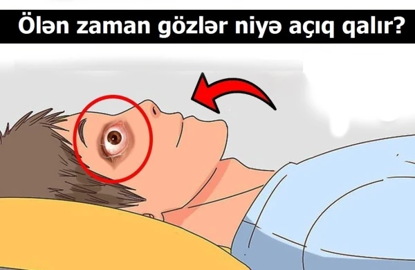 Ölən zaman insanın gözləri niyə açıq qalır? - AÇIQLANDI
