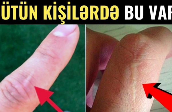 90 FAİZ KİŞİDƏ VAR - Sən Demə Bu Ləkə...(VİDEO)