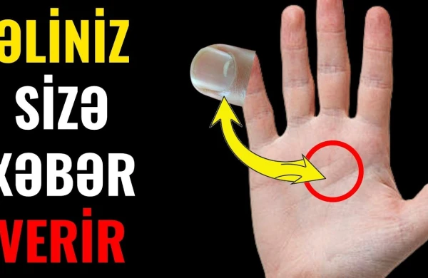 Əllərinizdə bunlar varsa, orqanizimdə bu 12 ŞEY baş verir