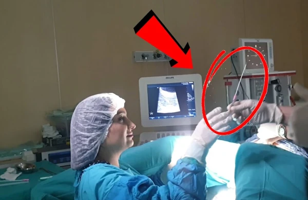 Şok əməliyyat görüntüsü - Süni mayalanma belə edilir!