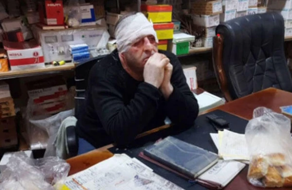 “Sədərək”də sahibkarı döyüb 30 min aparan şəxs tutuldu - FOTO
