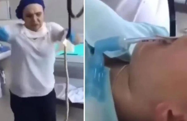 Həkim xəstənin mədəsindən ilan çıxardı - ƏMƏLİYYATIN VİDEOSU 18+