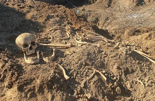 Ağdamda 30 il əvvəl öldürülərək basdırıldığı ehtimal olunan insan sümükləri aşkarlanıb