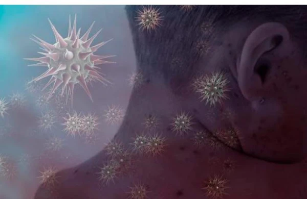 "COVİD"-19-dan sonra yeni virus yayılır — 3 nəfərdən birini öldürür