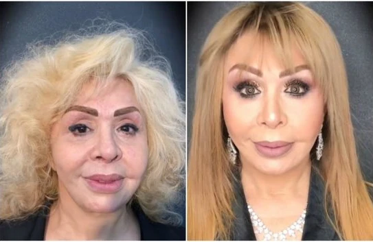 Ruhəngiz Allahverdiyevanın görün neçə yaşı var imiş 