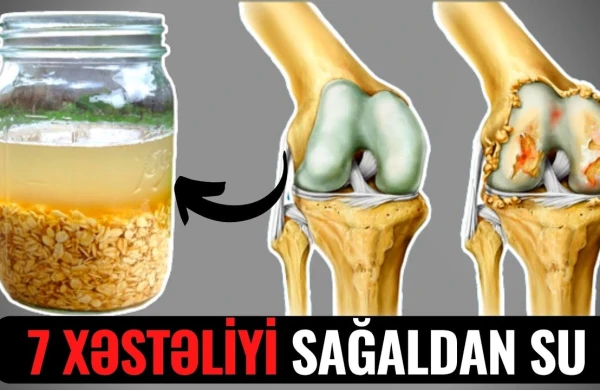 7 xəstəliyi sağaldan yulaf suyu - VİDEO