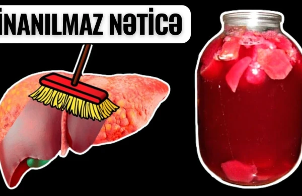 Qaraciyər, Təzyiq və Qəbizliyin Çarəsi - 1 Saata Sağaldır!
