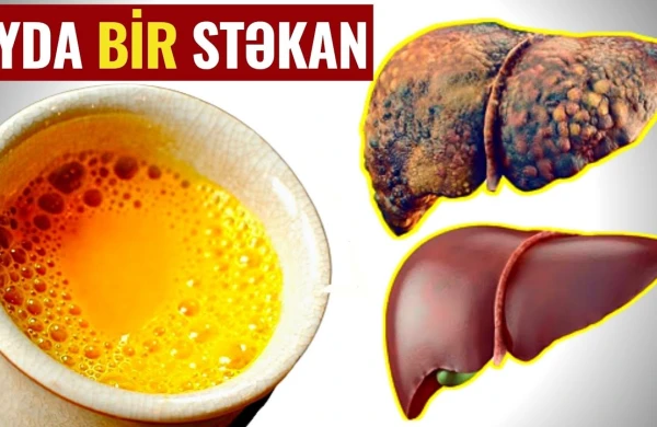 Qaraciyərin zəhərləndiyini göstərən 16 VACİB ƏLAMƏT