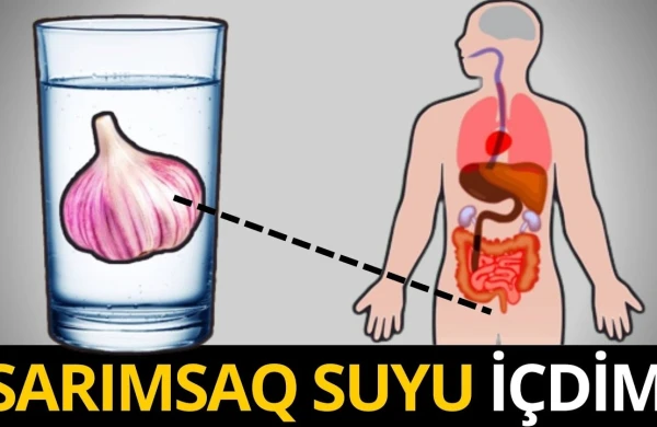 7 Gün Sarımsaq Suyu İçdim - Görün Başıma Nələr Gəldi...