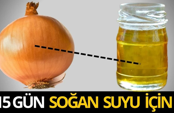 Gündə 3 dəfə Soğan Suyu İçin! -Görün nələrə dərman imiş +VİDEO