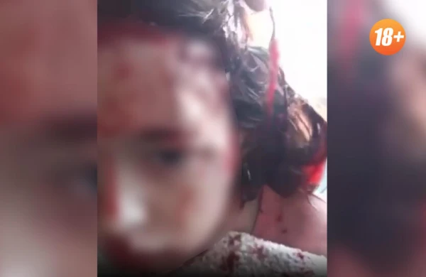 İt uşağın dərisini soydu - FOTO