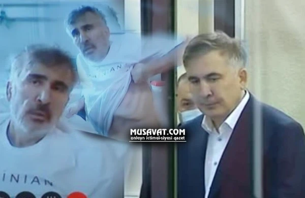 Saakaşvili tanınmaz halda - ŞOK GÖRÜNTÜLƏR
