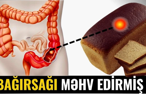 Bağırsaq xəstəliklərinin səbəbi çörəkdəki... - NİYƏ GİZLƏDİRLƏR?