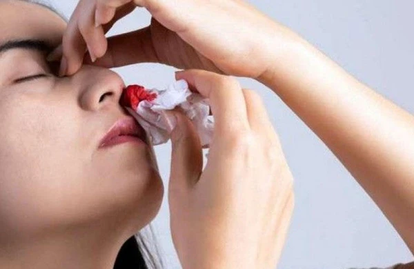 Burundan açılan qan hormonal problem əlamətidir